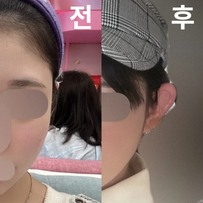 고민하고 있다면 받아야 해요. 대만족하고 있습니다.