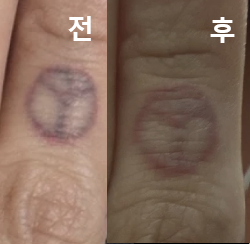 롤리팝만큼 편한 분위기, 자세한 상담, 합리적인 가격 삼박자가 다 갖춰진 곳이 없어요