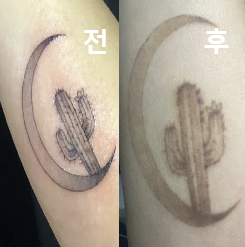 다른 병원보다 가격이 합리적이고 직원분들이 친절하셔서 재방문 했어요!