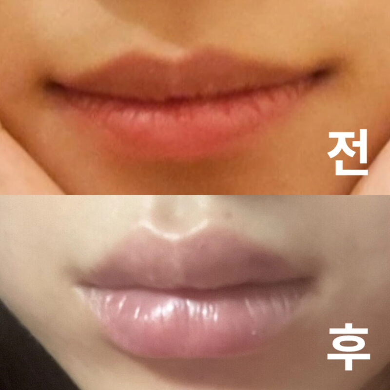 자연스럽게 딱 제가 원하는 느낌의 입술 만들어주셨어요 짱