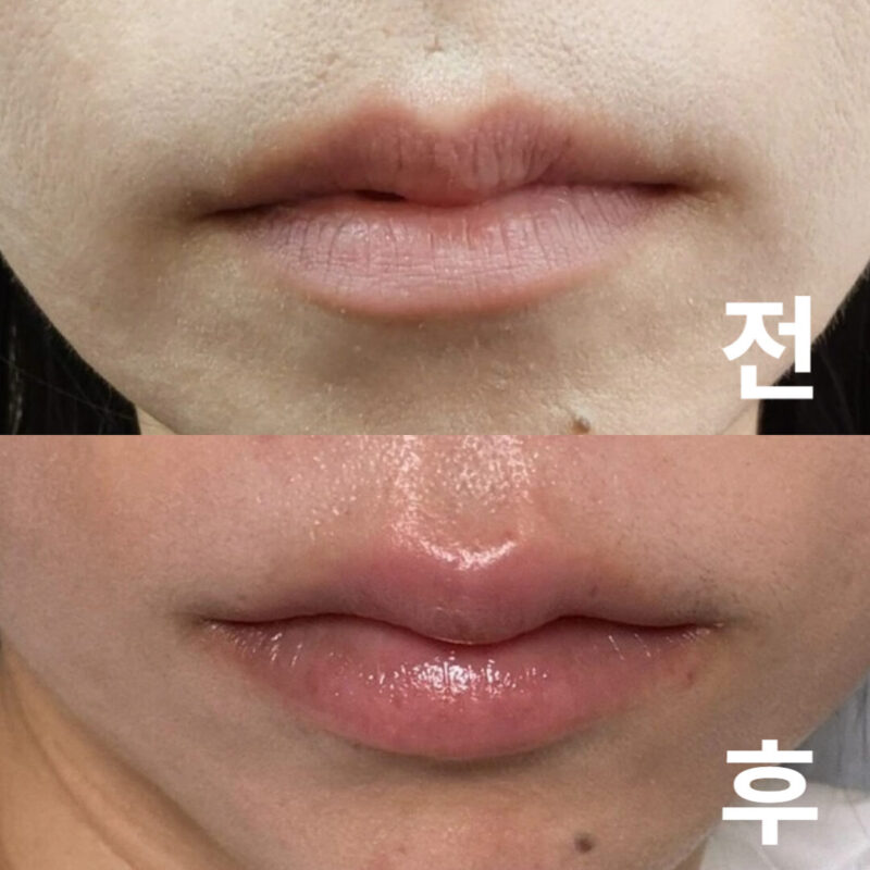 상담부터 시술까지의 안내가 아주 원활했어요