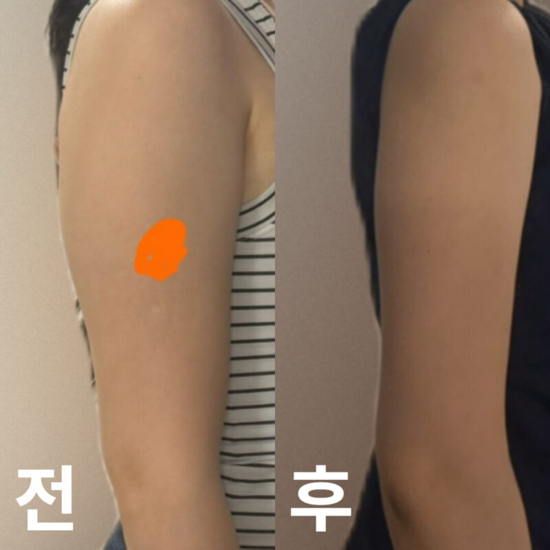제가 원하는 부위를 더 섬세하게 봐주십니다!!