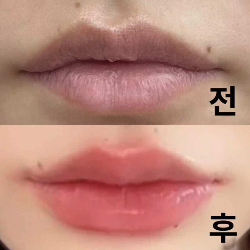 매우 안심하고 시술을 받을 수 있었습니다