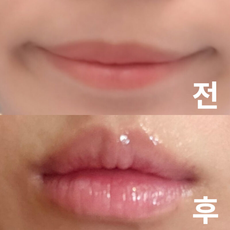 어울리는 디자인으로 친절하게 설명해주시면서 시술해주셨습니다!