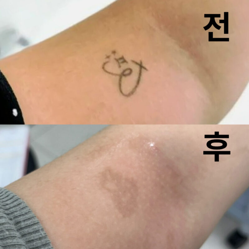 의사선생님이 꼼꼼하게 봐주시고 직원분들도 친절하세요