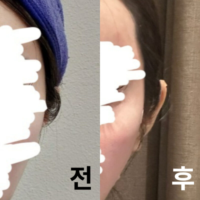 대만족입니다. 얼굴이 다른 사람으로 보여요.