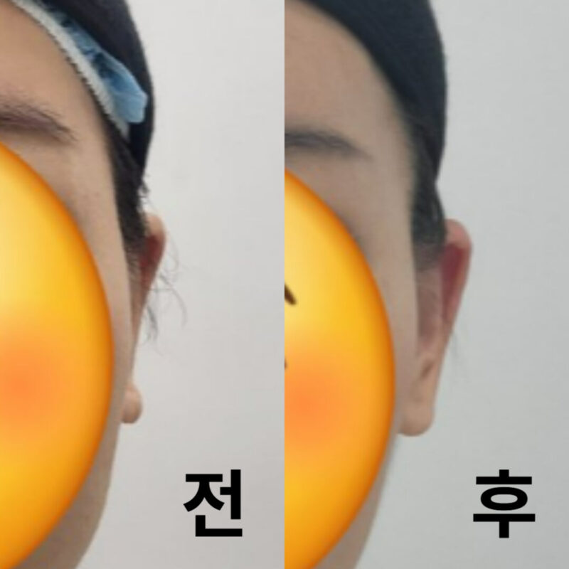즉각적으로 작은 얼굴 완성 가능!