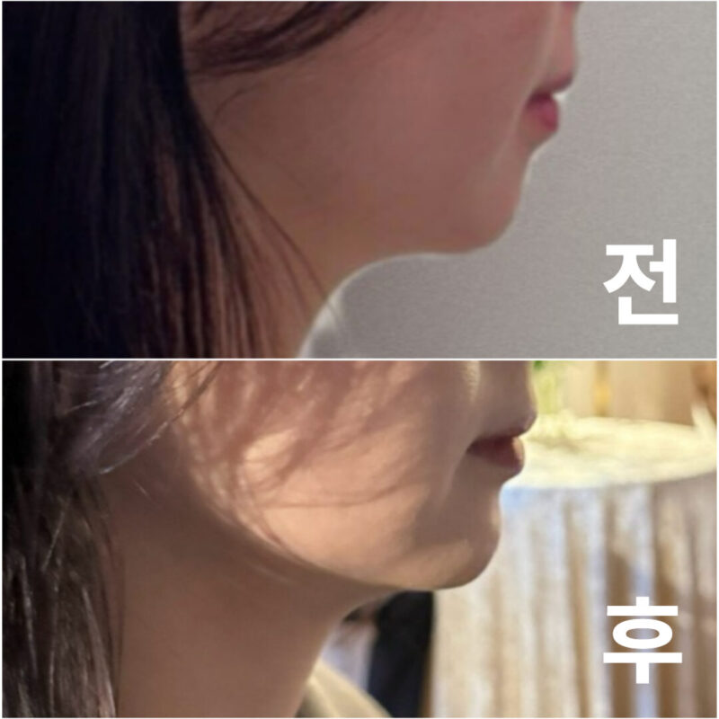오랜 콤플렉스가 일순간에 해소되어 정말 기쁩니다