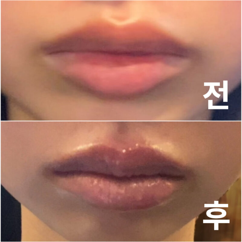 직후부터 제 입술이 너무 귀여웠어요