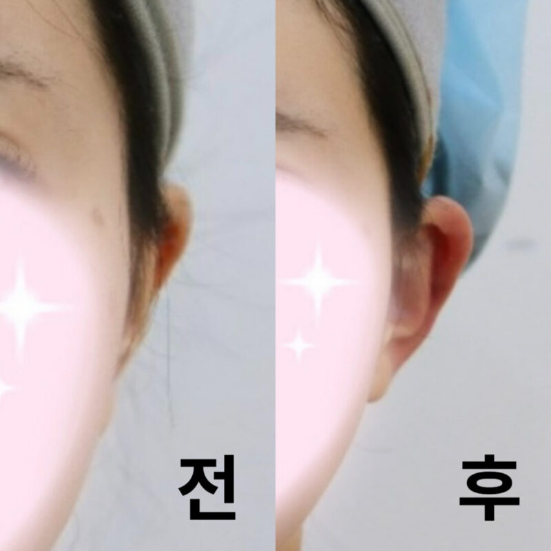 다른 클리닉과 비교할 수 없을 정도록 정중하고 상냥했습니다!