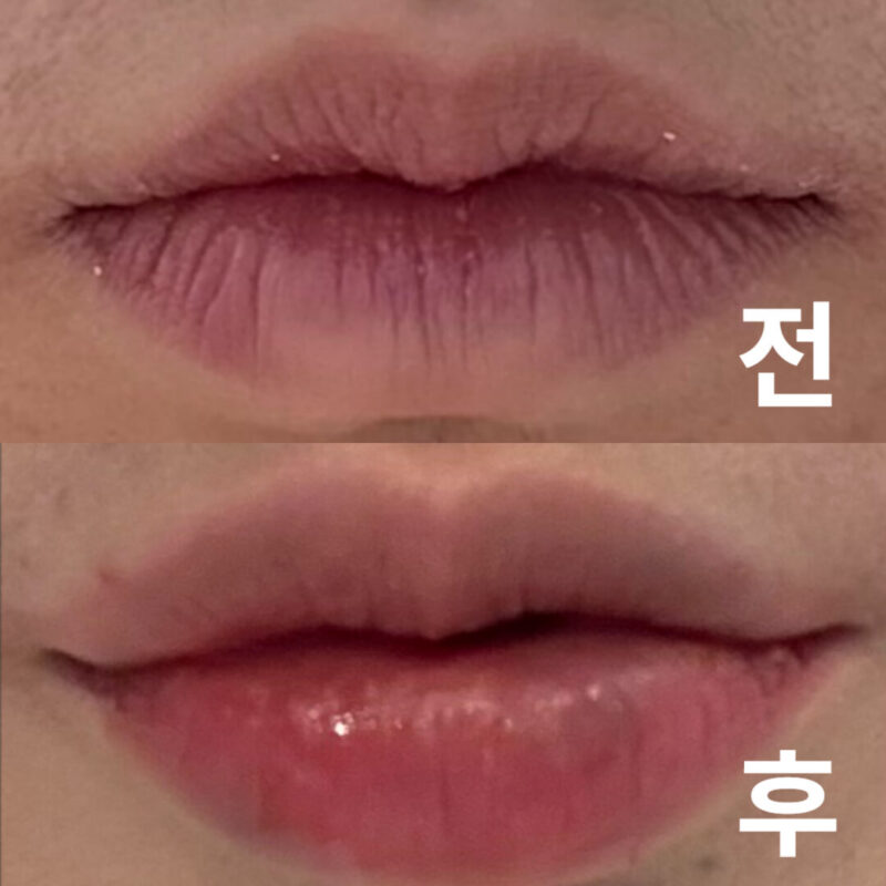 앞으로 여기에서만 맞을 거 같아요.