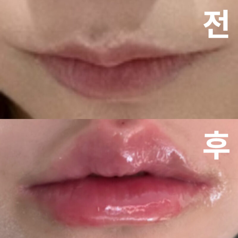 다른가게에 비해 저렴한데, 그럼에도 불구하고 고품질의 서비스를 받을 수 있었던 것이 기쁩니다.