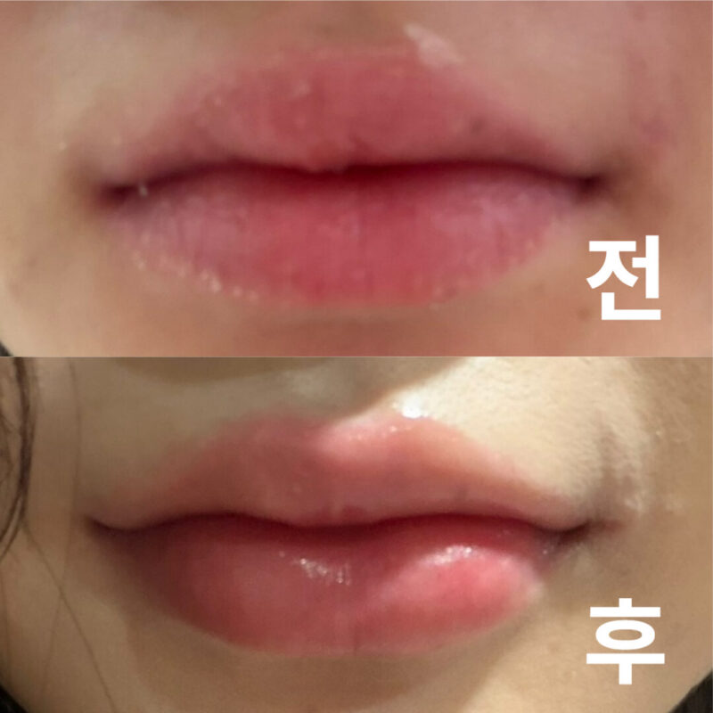 지난번에 맞았는데 만족했어서 맞으러 왔는데 이번에도 맘에 들어요!