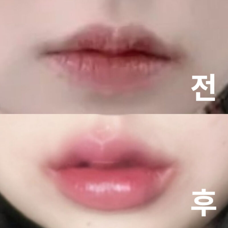상담도 너무 친절하게 잘해주시고 만족하고 있어요