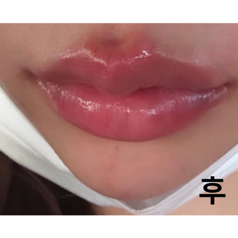 원내도 귀엽고 상담도 시술도 꼼꼼히 잘해주셔서 다시 가고 싶습니다!