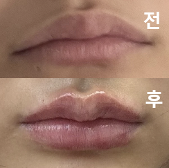 직원분들이 너무 친절하시고 예쁘게 시술 해 주셨어요!