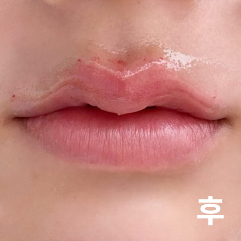벌써 입술이 예뻐져서 정말 기뻐요