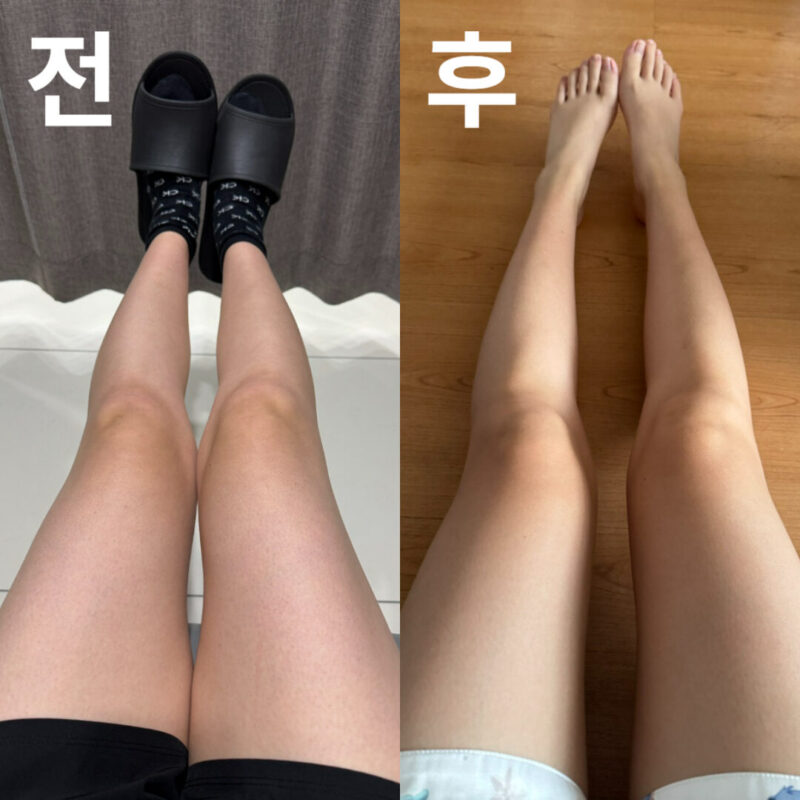1개월이 지나니 다리와 복부 주변이 한결 슬림해졌어요