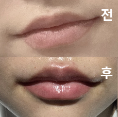 상담도 꼼꼼하고 가격도 부담스럽지 않았어요!