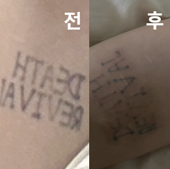 다른 곳도 많이 다녀봤는데 롤리팝이 가격도 가장 합리적이고 효과도 좋았어요!