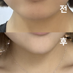추구미 따라잡기 성공했어요!