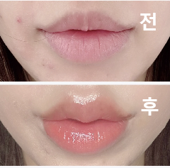 멍도 없고, 엄청 귀여운 입술이 되었어요!