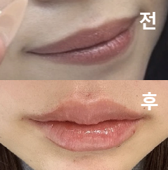 상담도 꼼꼼하고 다들 친절하셨어요!